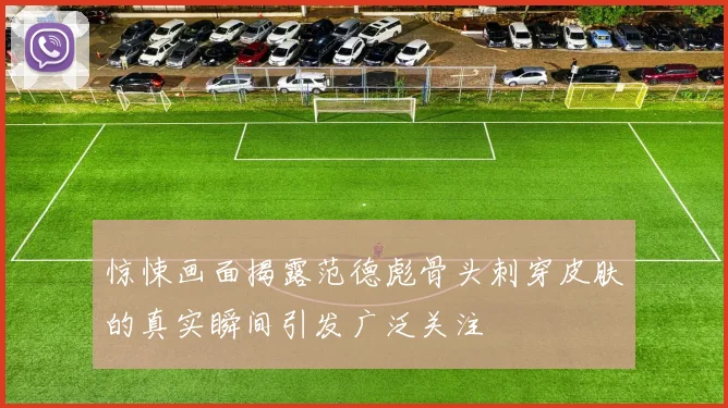 惊悚画面揭露范德彪骨头刺穿皮肤的真实瞬间引发广泛关注